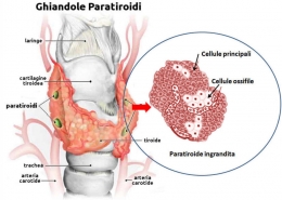 tiroide-marta-simonetto-naturopata-studio-naturopatia-busto-arsizio-mozzate-paratiroidi