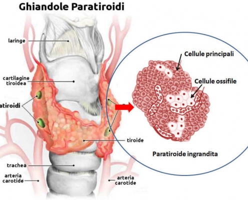 tiroide-marta-simonetto-naturopata-studio-naturopatia-busto-arsizio-mozzate-paratiroidi